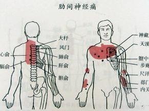 疼痛最新疗法，探索与突破的成果分享